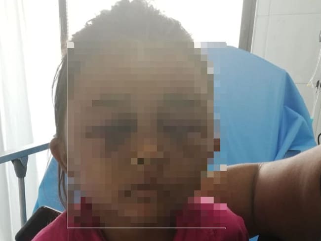 Menor maltratada por la madrastra sigue hospitalizada en Montería