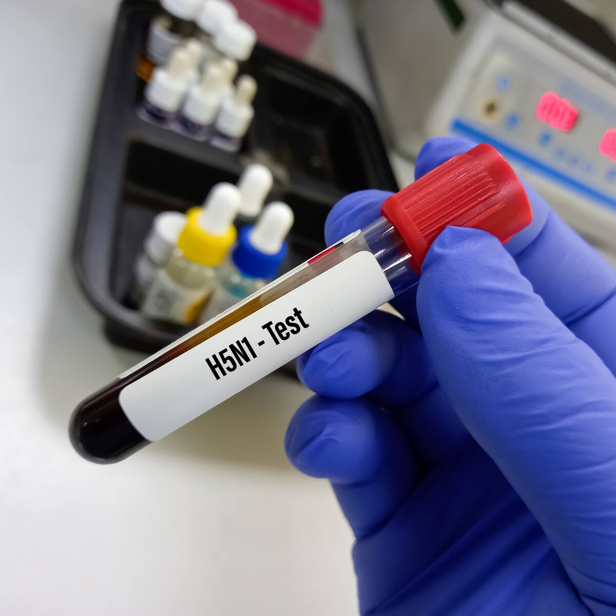 “Asegurarse de que no tenga potencial de pandemia”: epidemiólogo por cepa de gripe aviar en EE.UU.