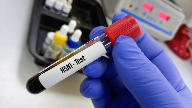 “Asegurarse de que no tenga potencial de pandemia”: epidemiólogo por cepa de gripe aviar en EE.UU.