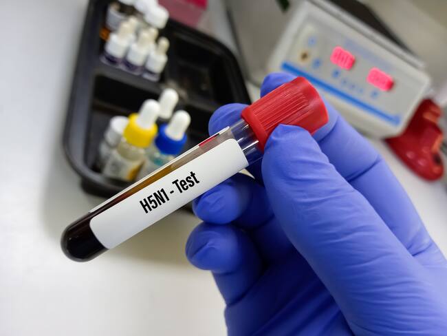 “Asegurarse de que no tenga potencial de pandemia”: epidemiólogo por cepa de gripe aviar en EE.UU.