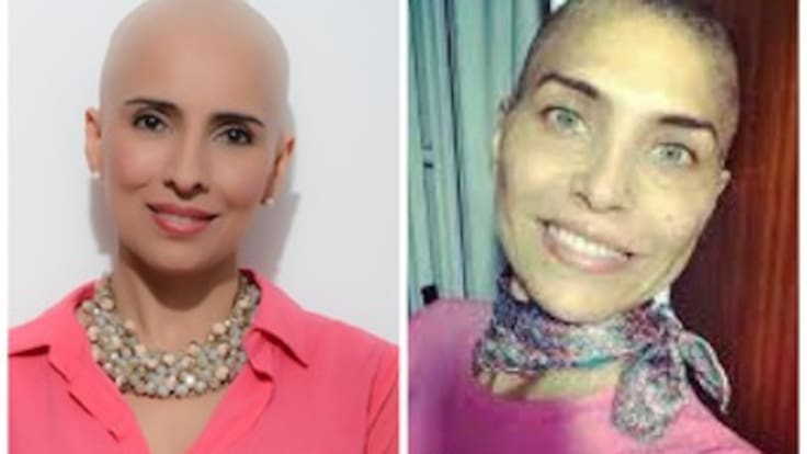 Lorena Meritano cuenta su historia de cómo superó el cáncer