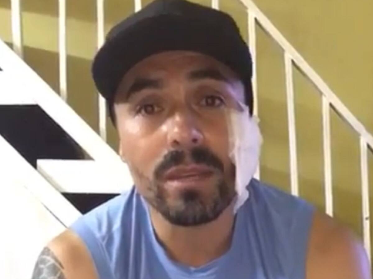 Vladimir Marín sufrió un grave accidente y solicita ayuda para ser operado