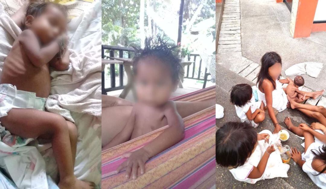 Cuatro niños indígenas murieron por brote (foto referencial)