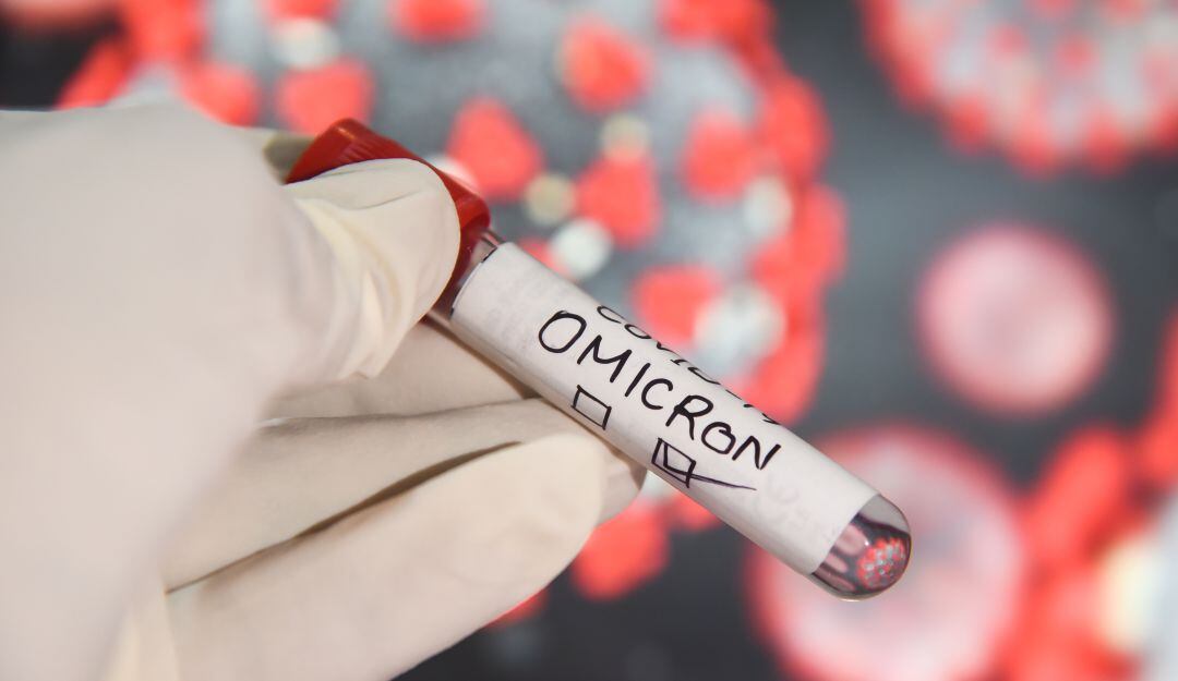 Ómicron: Síntomas que pueden indicar que tiene el virus