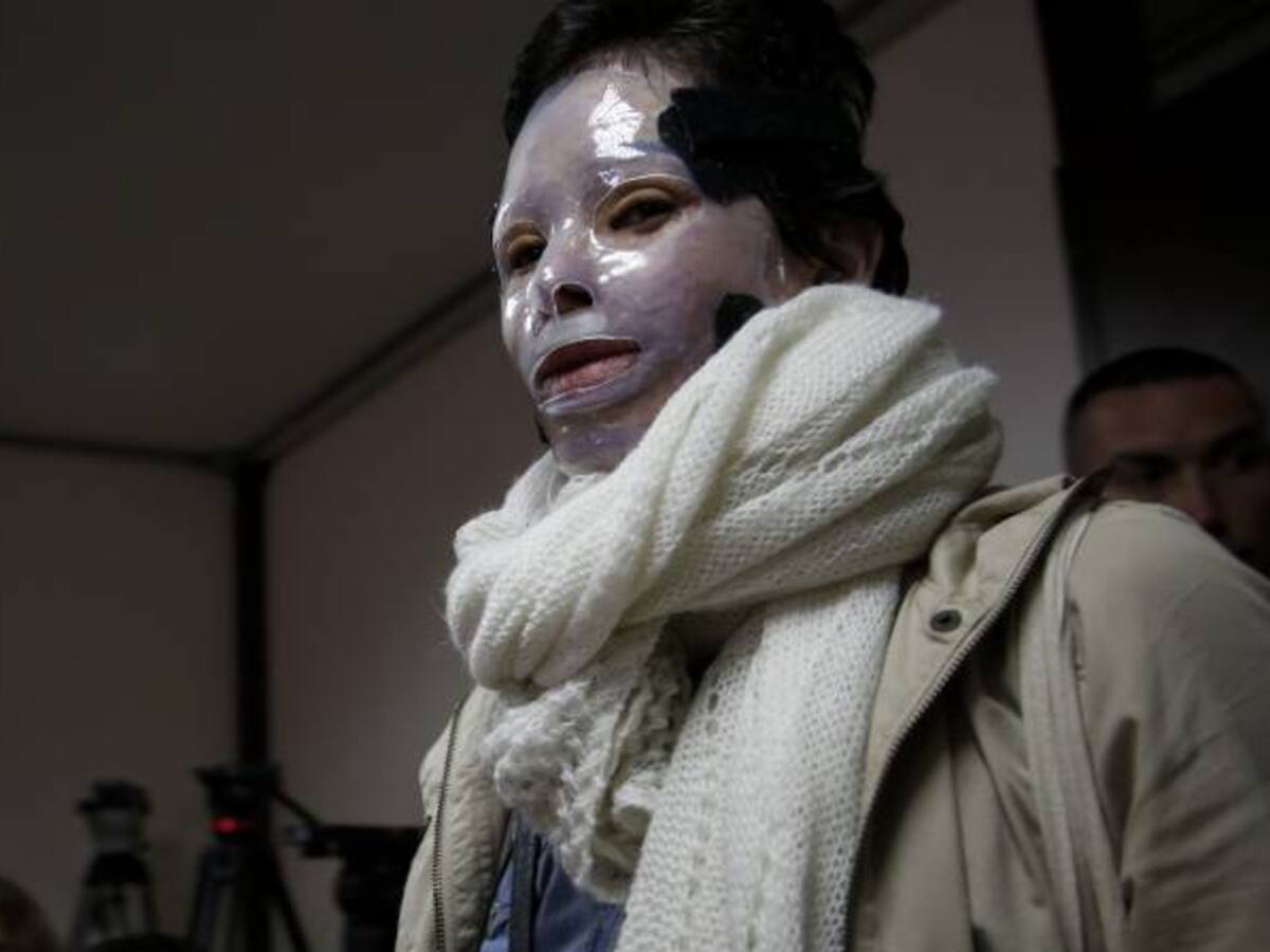 A sanción presidencial ley que endurece las penas para ataques con ácidos