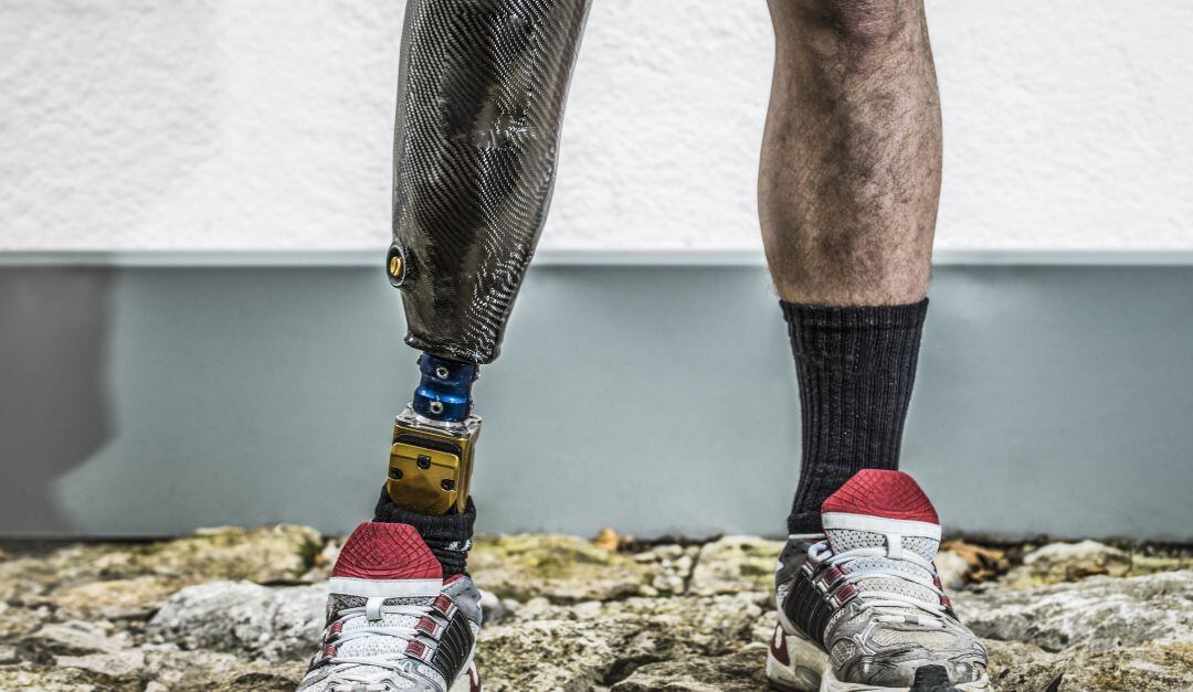 Por una imagen viral papá e hijo recibirán unas prótesis