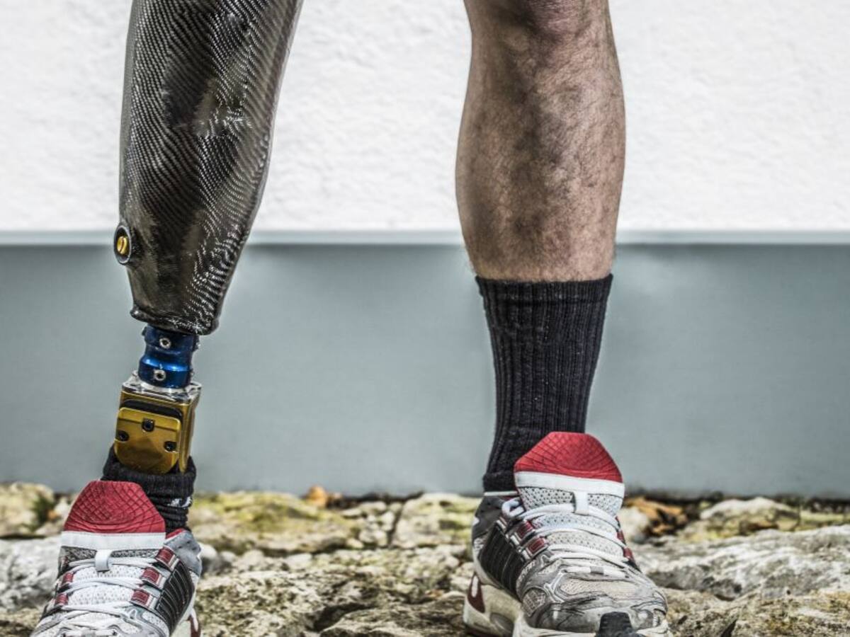 Por una imagen viral papá e hijo recibirán unas prótesis