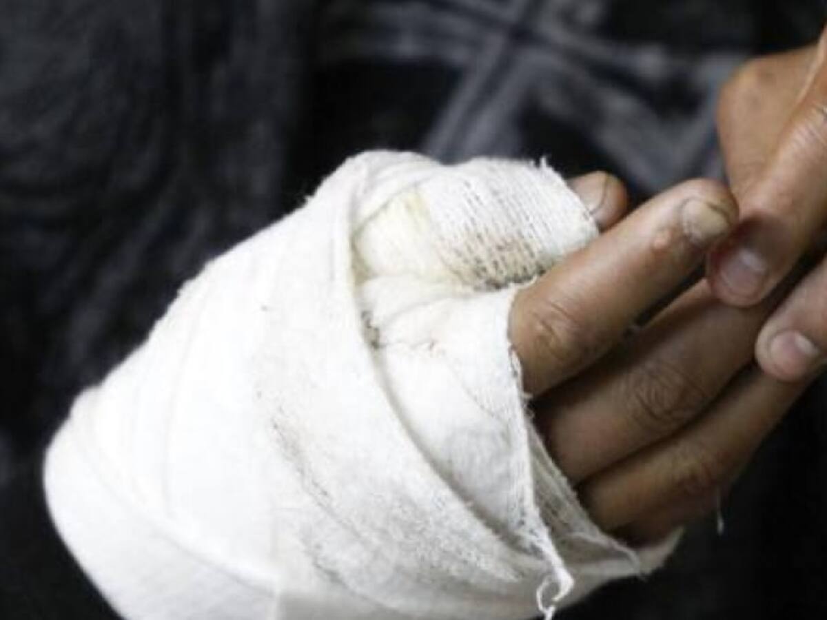 Van 13 quemados por pólvora en Risaralda: un menor indígena entre las últimas víctimas