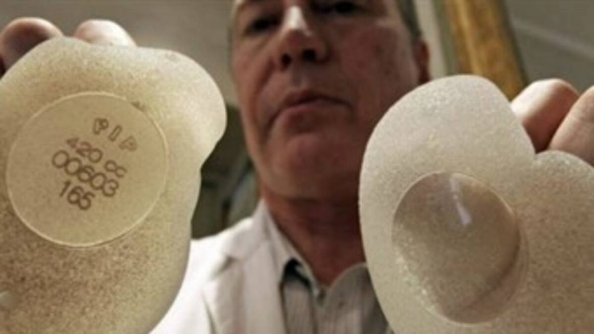 Los implantes mamarios PIP no son tóxicos ni cancerígenos, según un informe