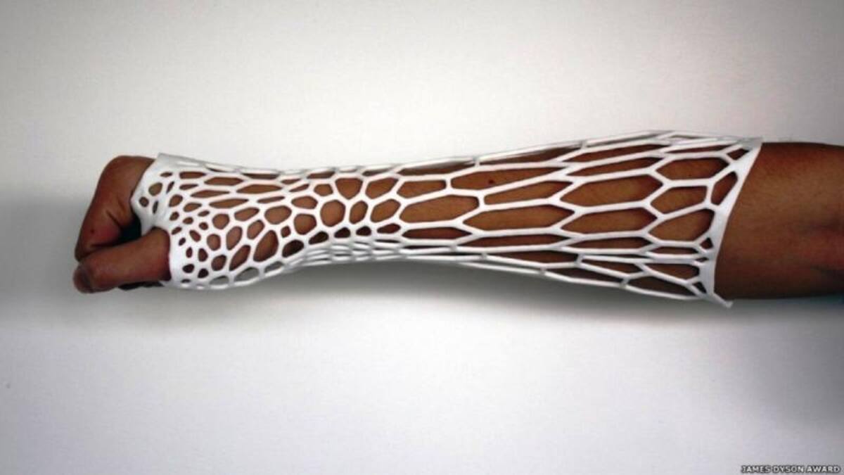 La Cortex es una escayola impresa en 3D que intenta abordar los problemas de las alternativas de yeso: son pesadas, causan picazón y dan olor. Los creadores neozelandeses subrayan que está hecha de plástico reciclable