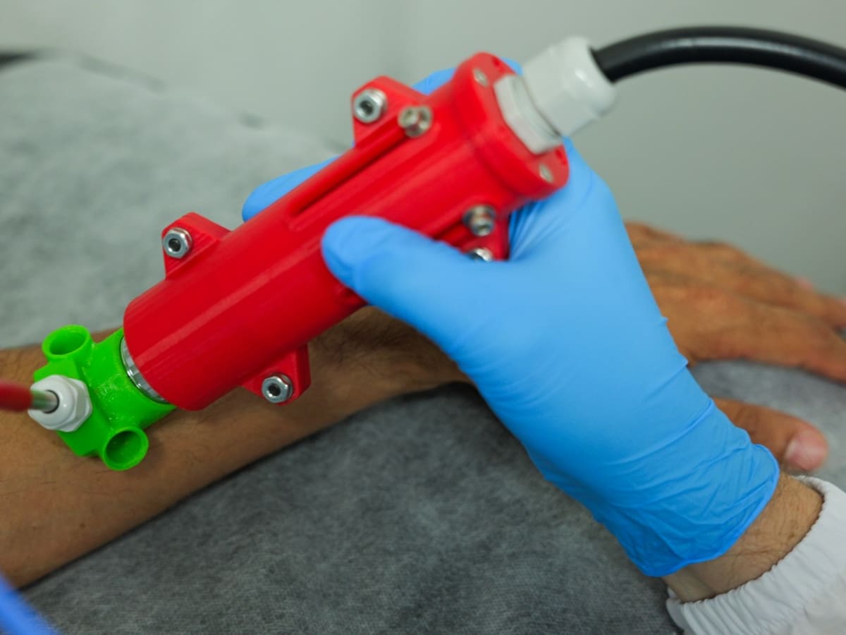 Nuevo dispositivo creado en Medellín ayudará a acelerar el tratamiento de la leishmaniasis