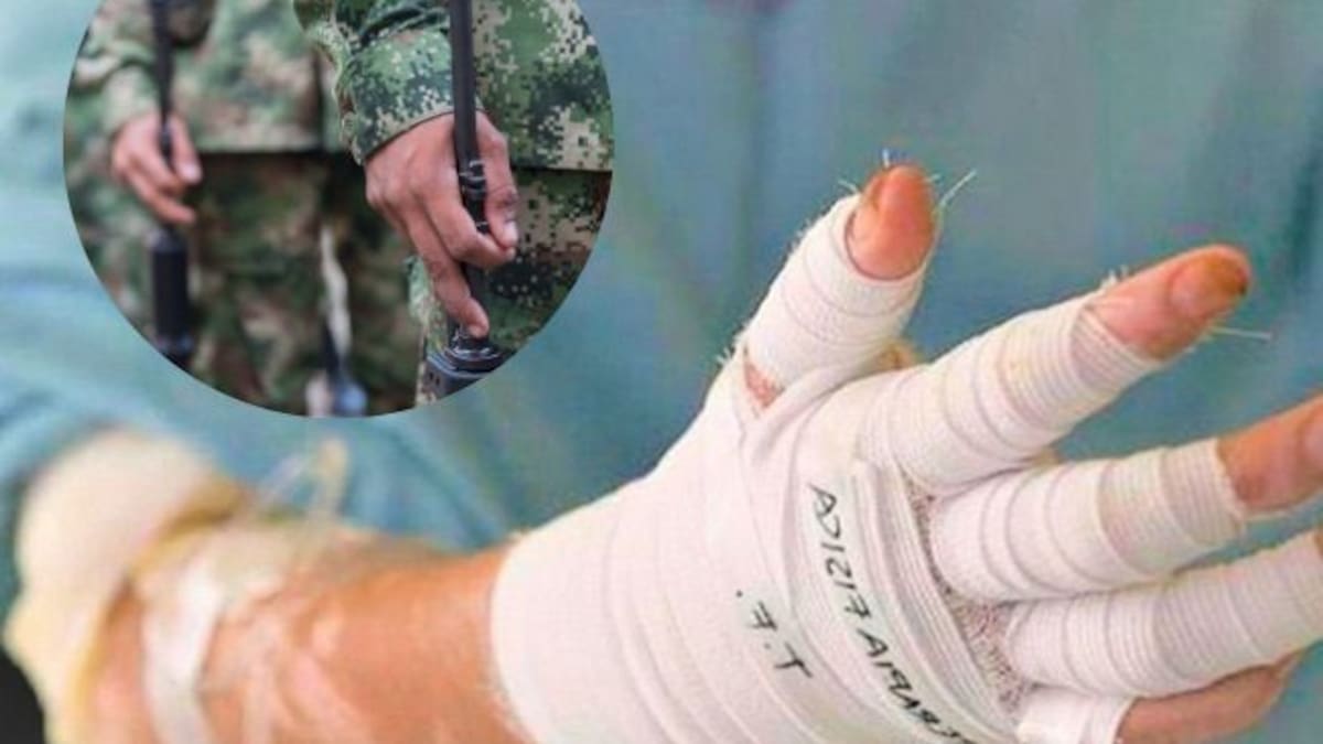 “Le quemaron el cuerpo, pero gracias a Dios mi hijo está vivo”: madre de soldado herido en Putumayo