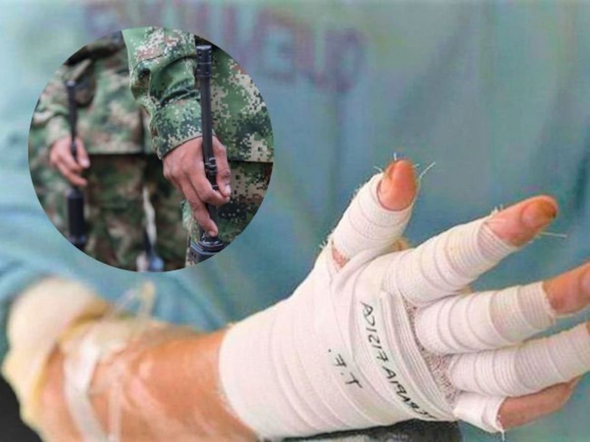 Hospital Militar reporta estado crítico de subteniente quemado en Putumayo