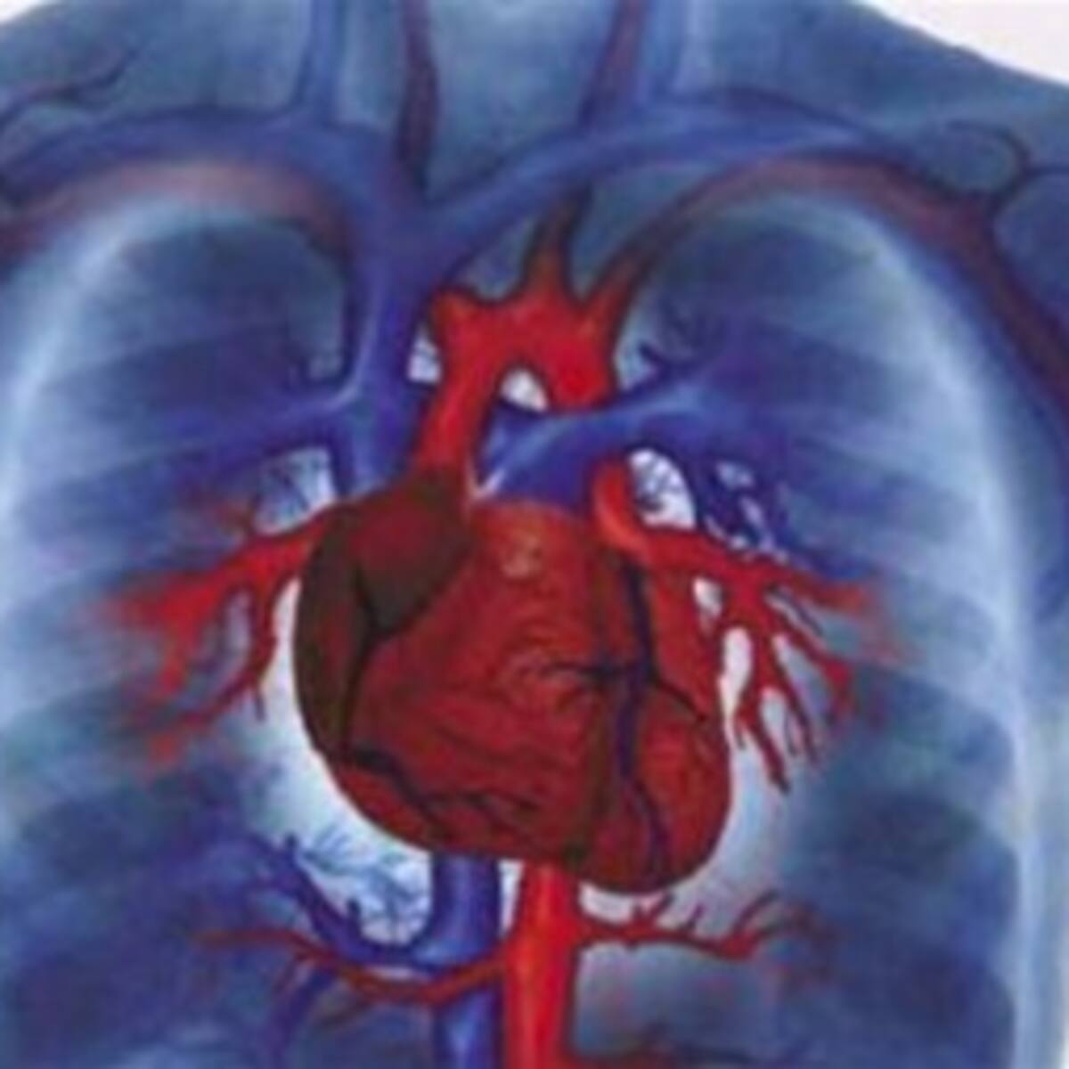 Los lunes entre las 6 de la mañana y el mediodía hay más riesgo de sufrir un infarto