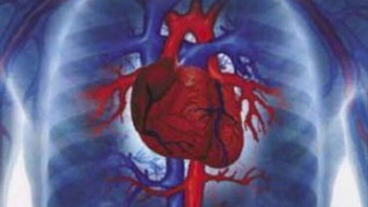 Los lunes entre las 6 de la mañana y el mediodía hay más riesgo de sufrir un infarto