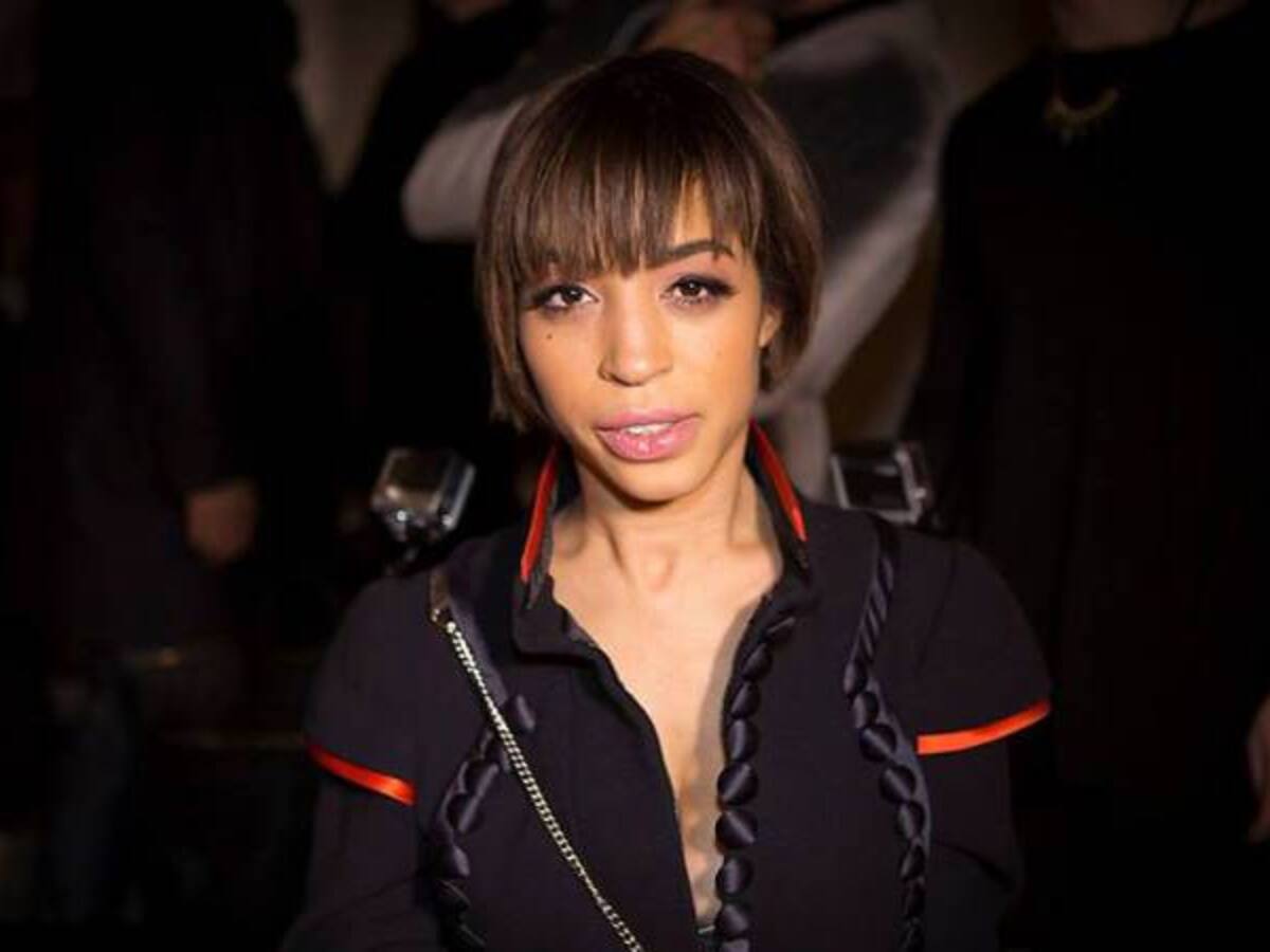 La joven con distrofia muscular escogida por Beyoncé para modelar su ropa