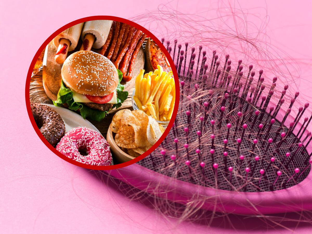 ¿Cuáles son los alimentos que debería evitar para prevenir la caída del cabello?