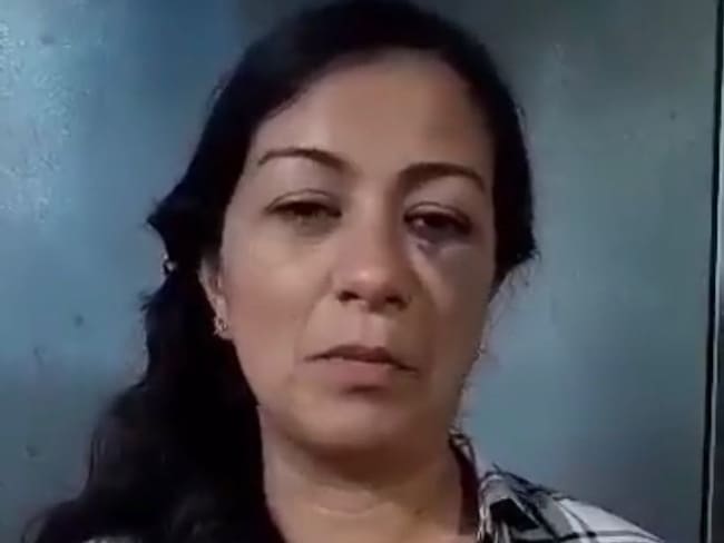 Docente agredida / Cortesía