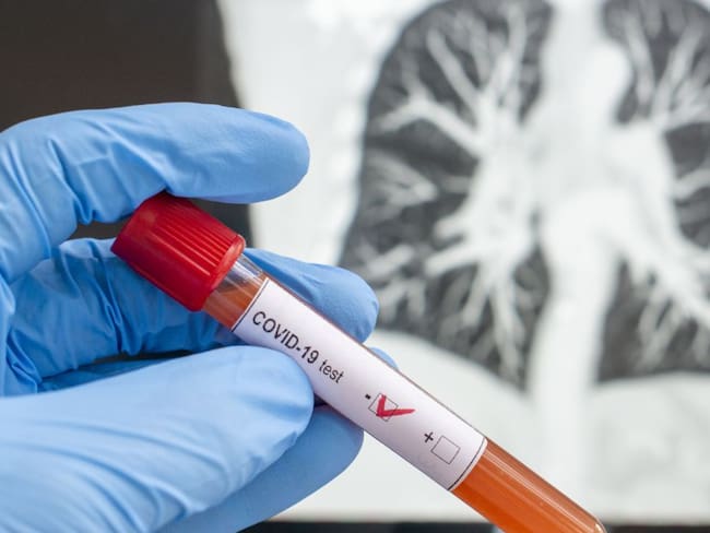 Juez ordena exámenes de COVID-19 para reclusos de la URI de Sincelejo