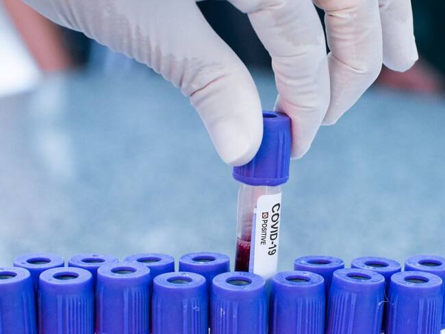 En Colombia cada 26 minutos un indígena se contagia de COVID-19, según Onic