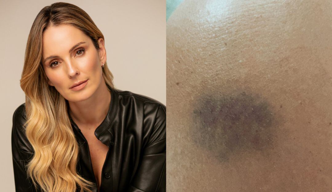  Claudia Bahamón fue atracada en Bogotá