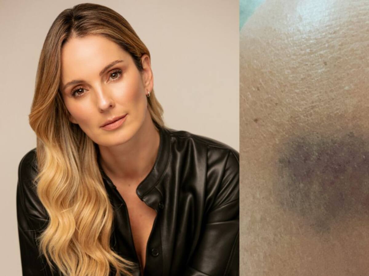 Claudia Bahamón fue atracada y arrastrada por una moto en Bogotá