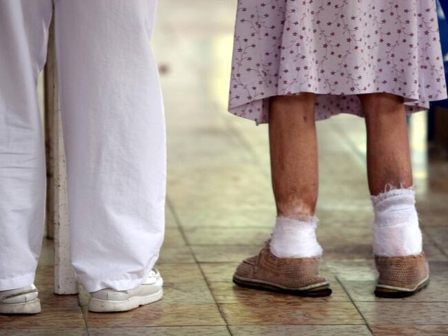 Procuraduría exige a gobernación del Valle respuesta sobre casos de lepra