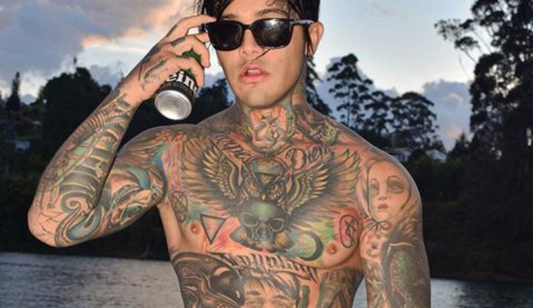 Yeferson Cossio, influencer que se puso senos, no podrá caminar en 5 meses