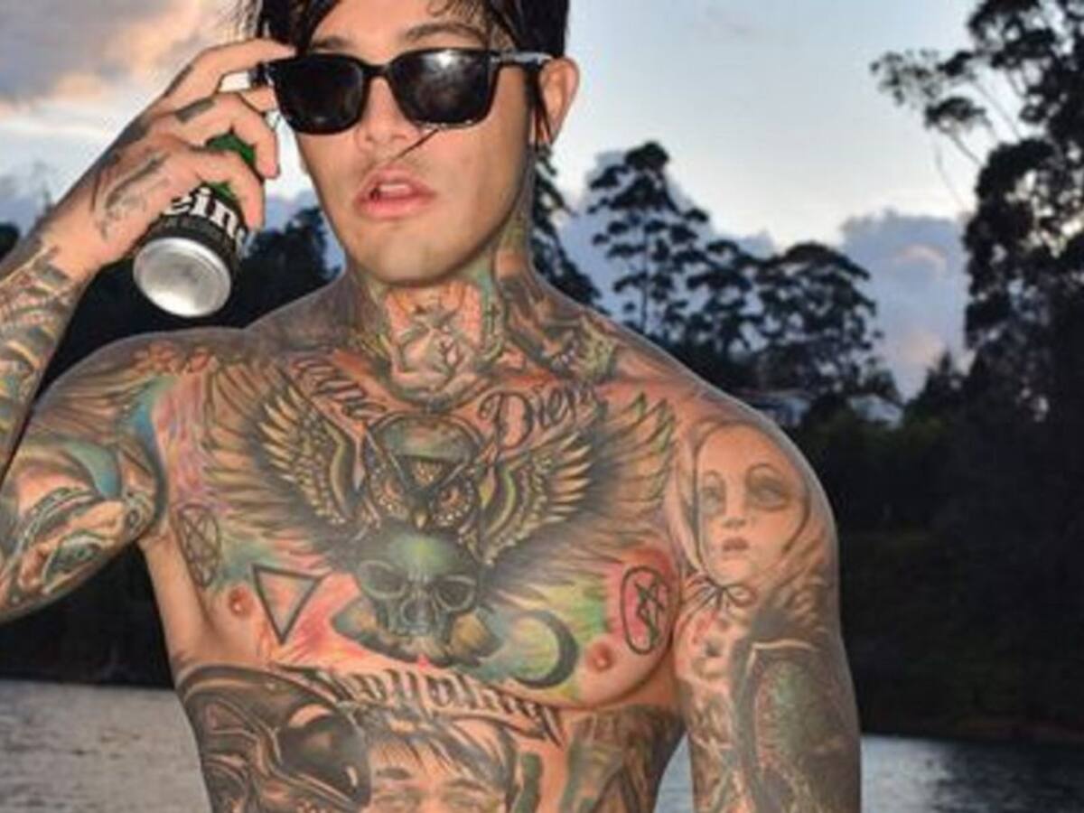 Yeferson Cossio, influencer que se puso senos, no podrá caminar en 5 meses