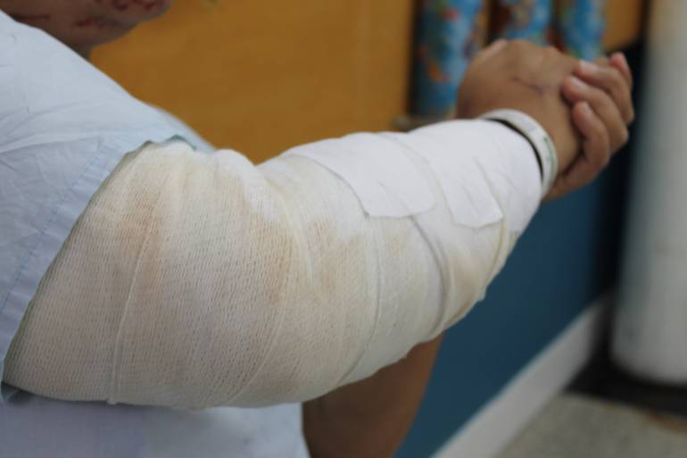 Aumenta el número de personas lesionadas con pólvora en Antioquia 