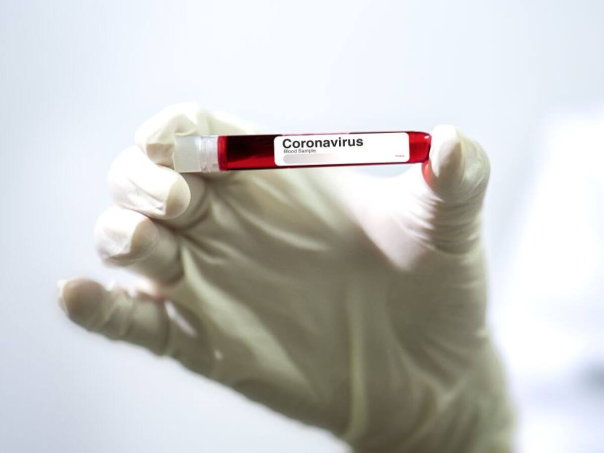 Perú confirma su primer caso de coronavirus