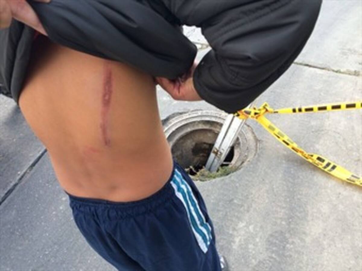 Menor resulta herido por caer a una alcantarilla sin tapa en Bogotá