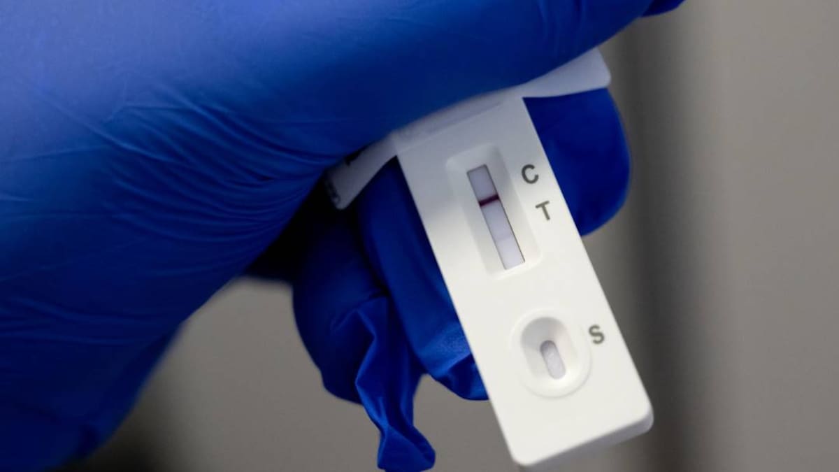 Francia registra más de 200 mil casos de COVID-19 en las últimas 24 horas