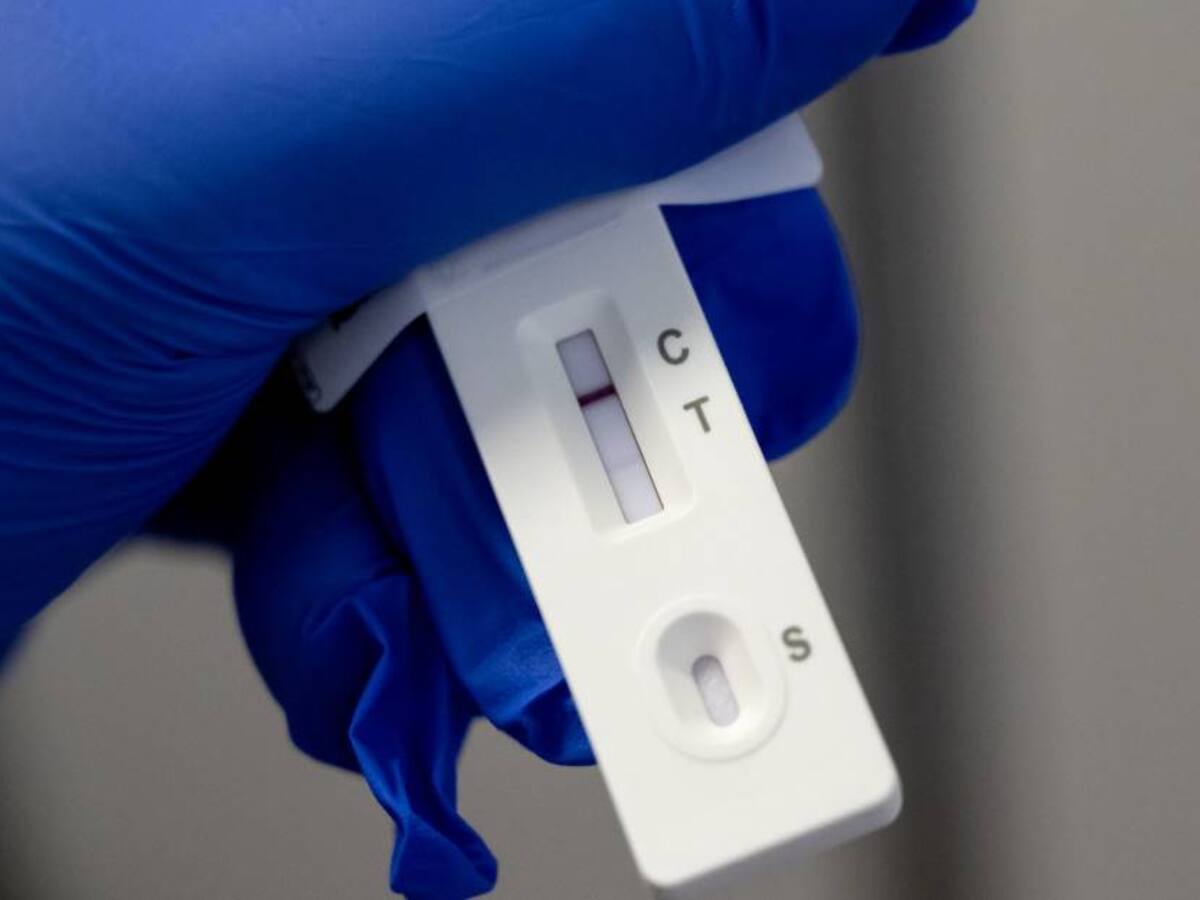 Francia registra más de 200 mil casos de COVID-19 en las últimas 24 horas