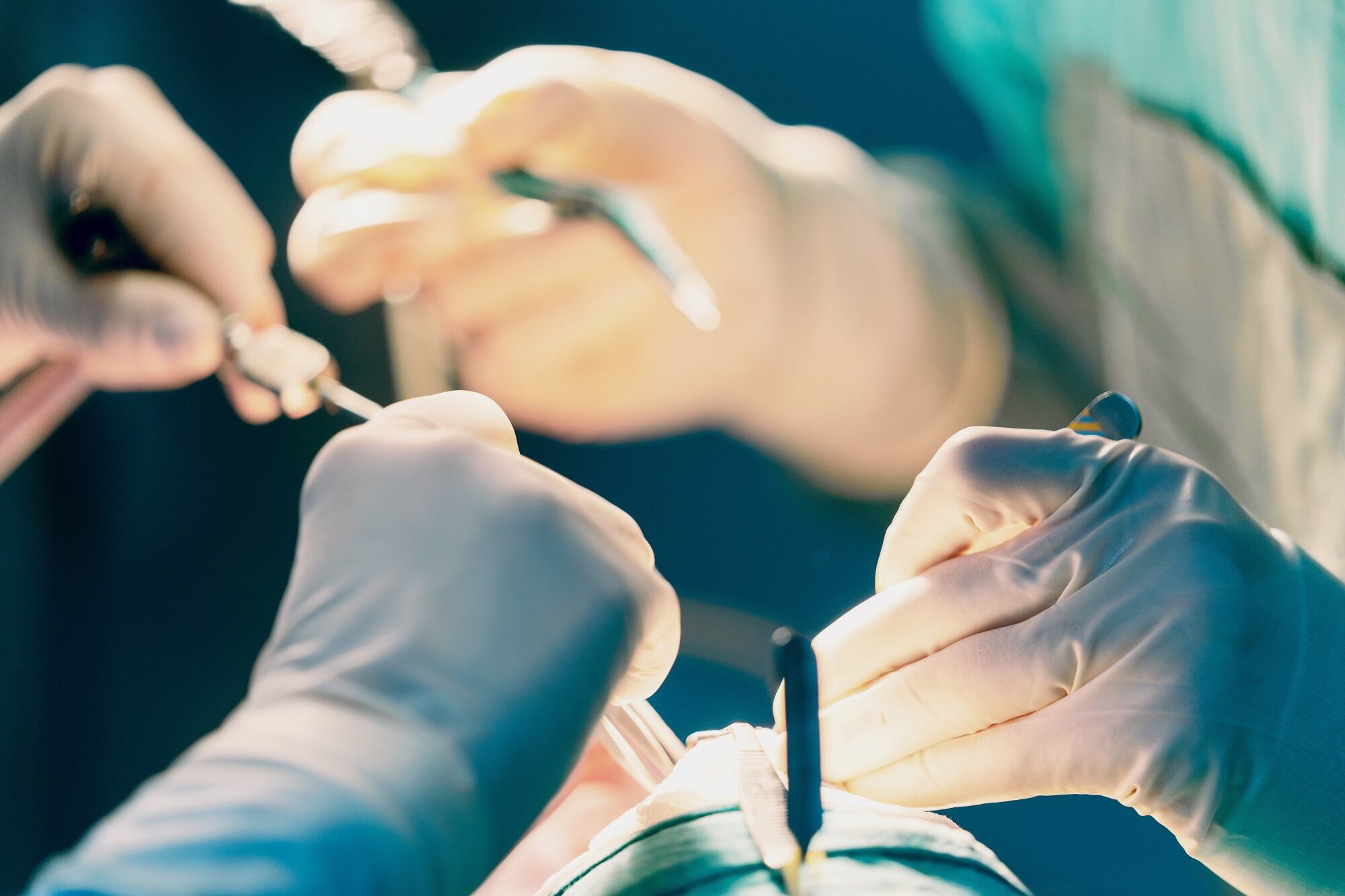 Imagen de referencia de procedimiento estético