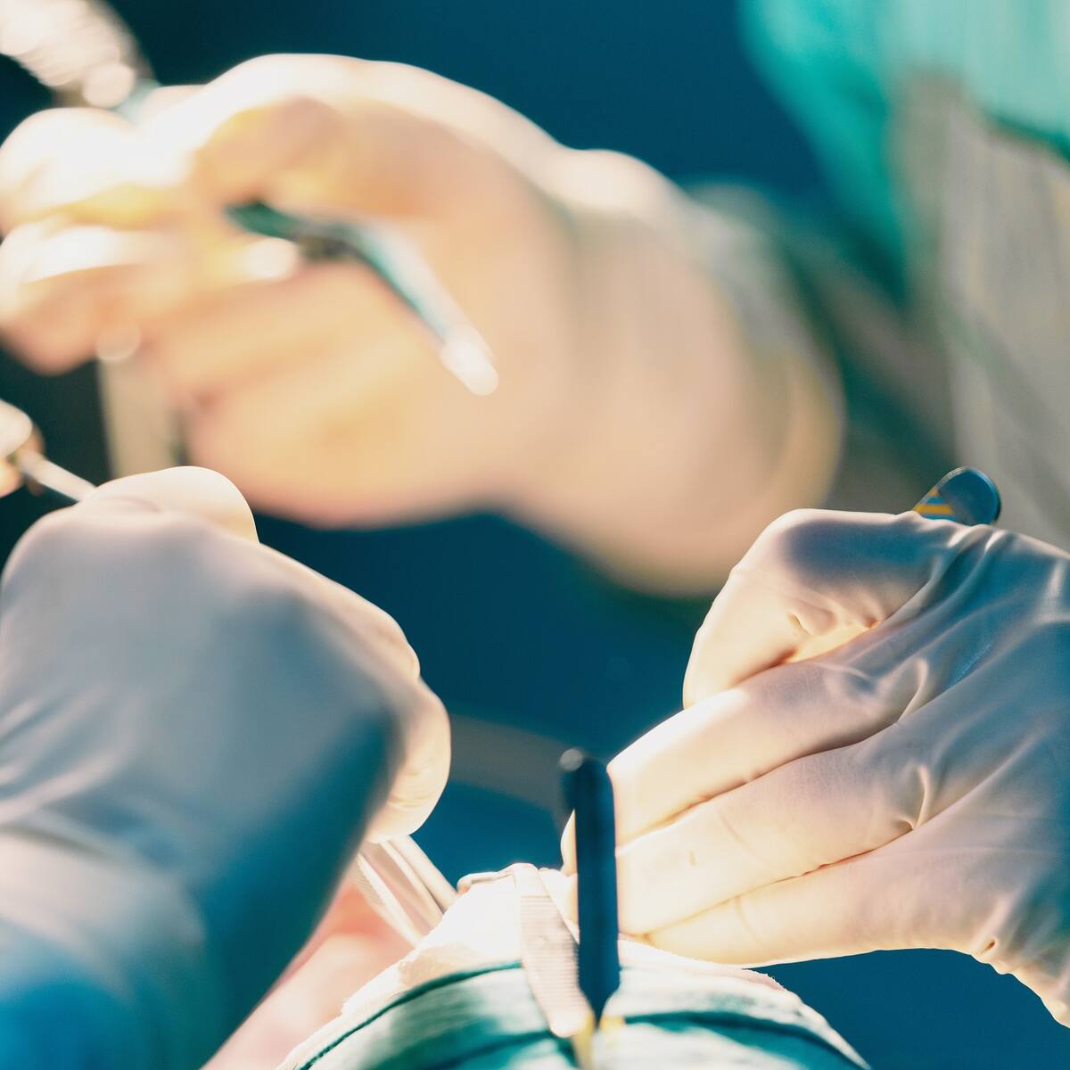 Políticos bajo el bisturí: crece la demanda de retoques estéticos entre figuras públicas