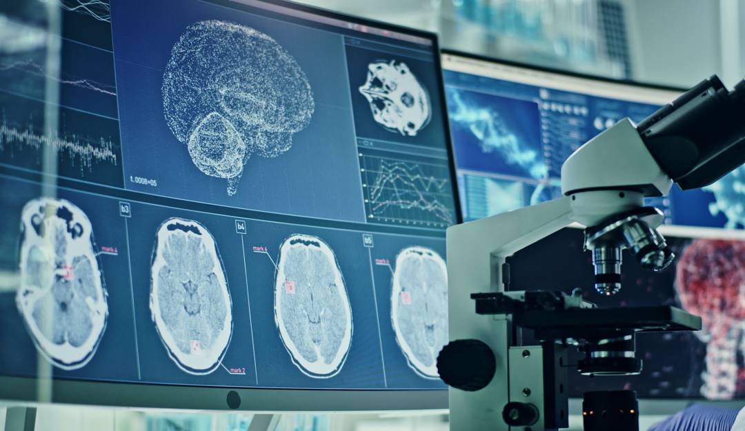 Análisis de situación cerebral de las personas contagiadas con coronavirus.           Foto: Getty 