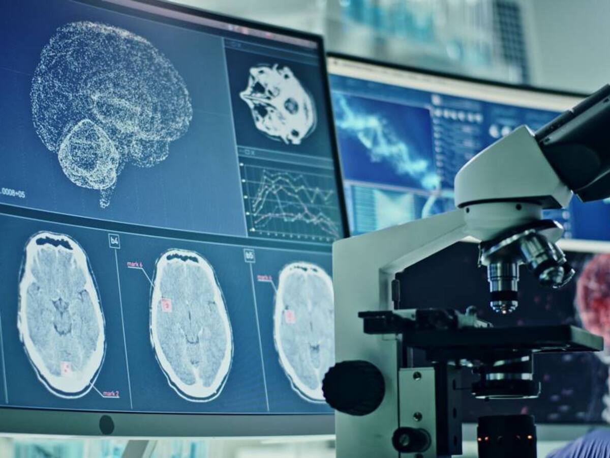 Impacto de COVID-19 grave equivale a envejecimiento cerebral de 20 años