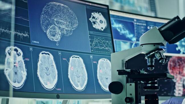 Análisis de situación cerebral de las personas contagiadas con coronavirus. Foto: Getty