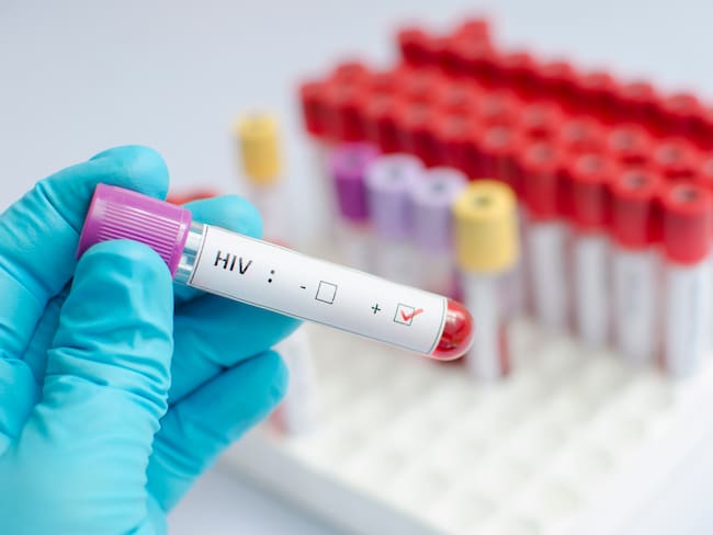 VIH (créditos: GettyImages)