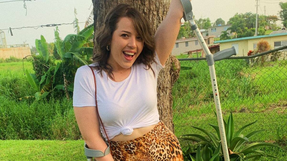 "Debo mantener la pierna fuerte, porque es la única que tengo"