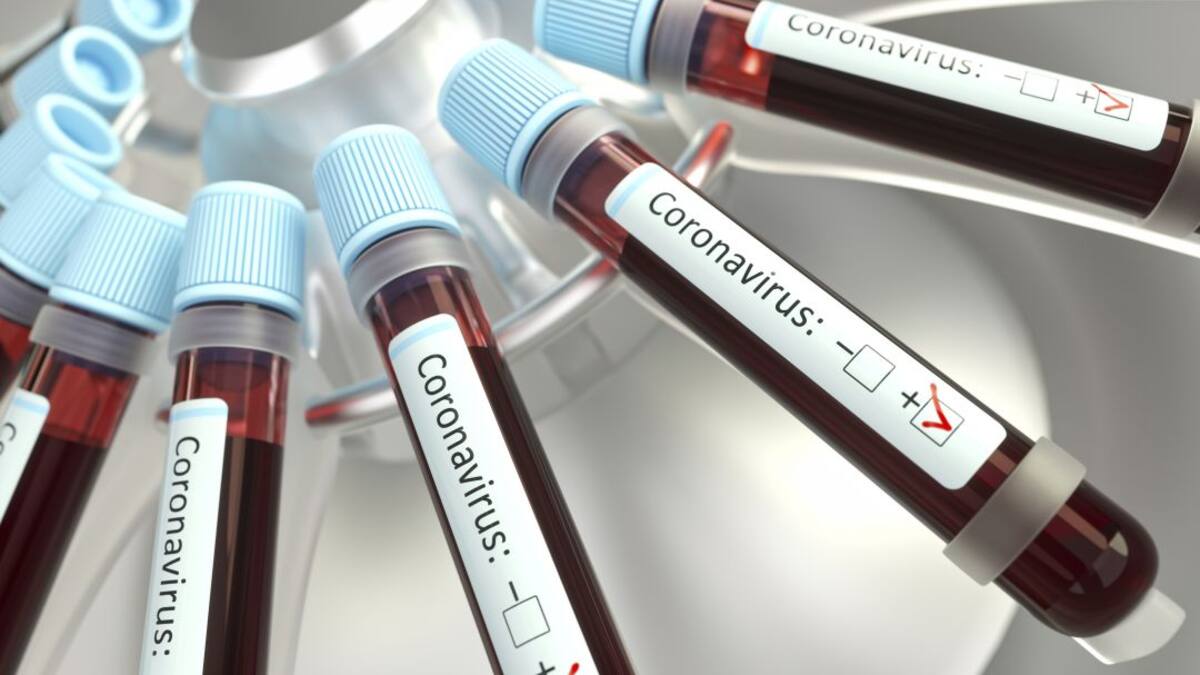Cifra histórica: En un día se reportan en Boyacá 402 casos de covid -19