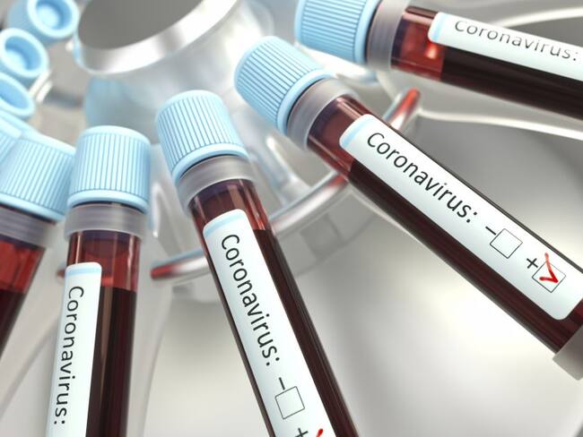 Cifra histórica: En un día se reportan en Boyacá 402 casos de covid -19