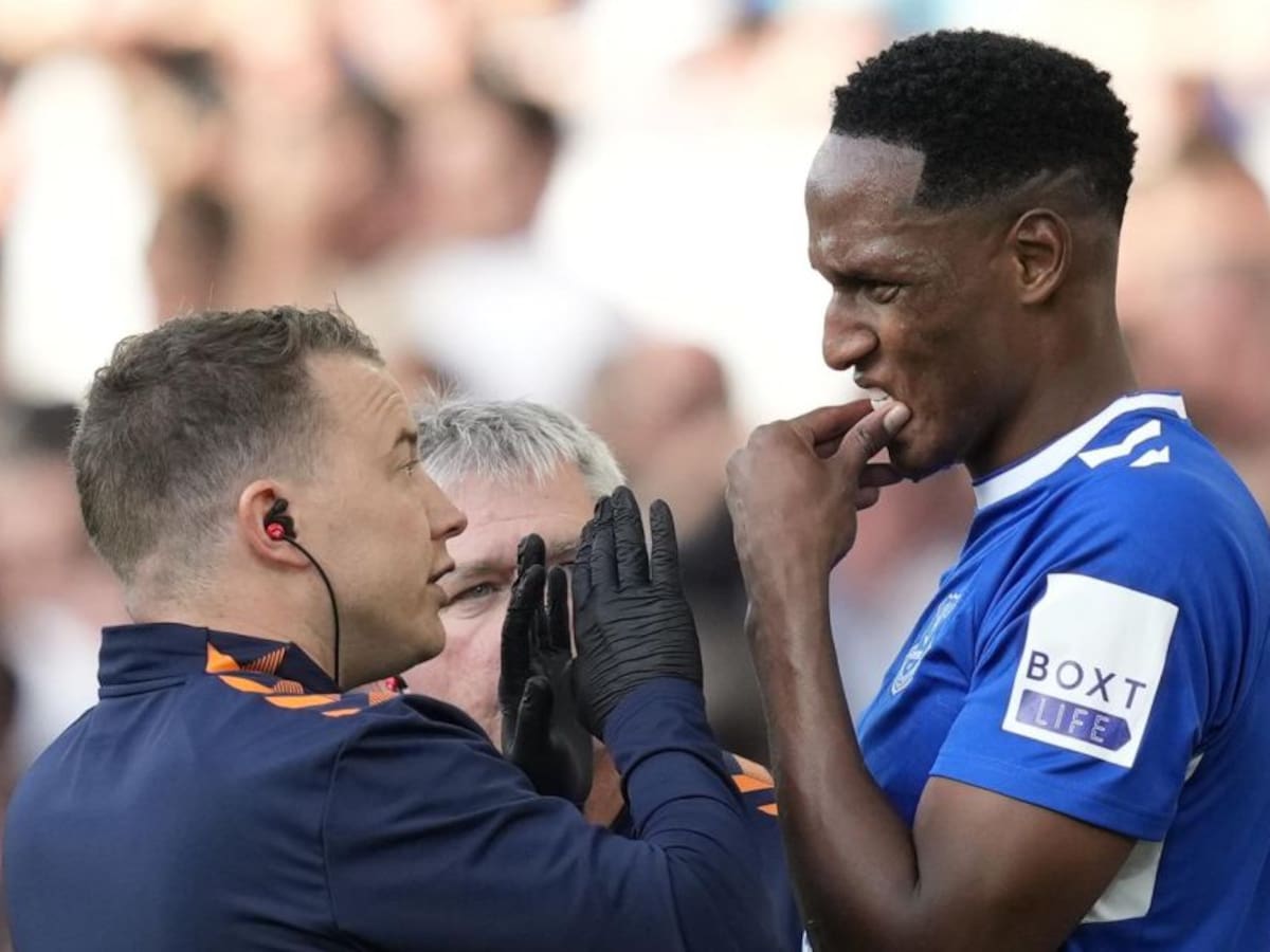 Yerry Mina retrasa su regreso con el Everton por un “pequeño contratiempo”