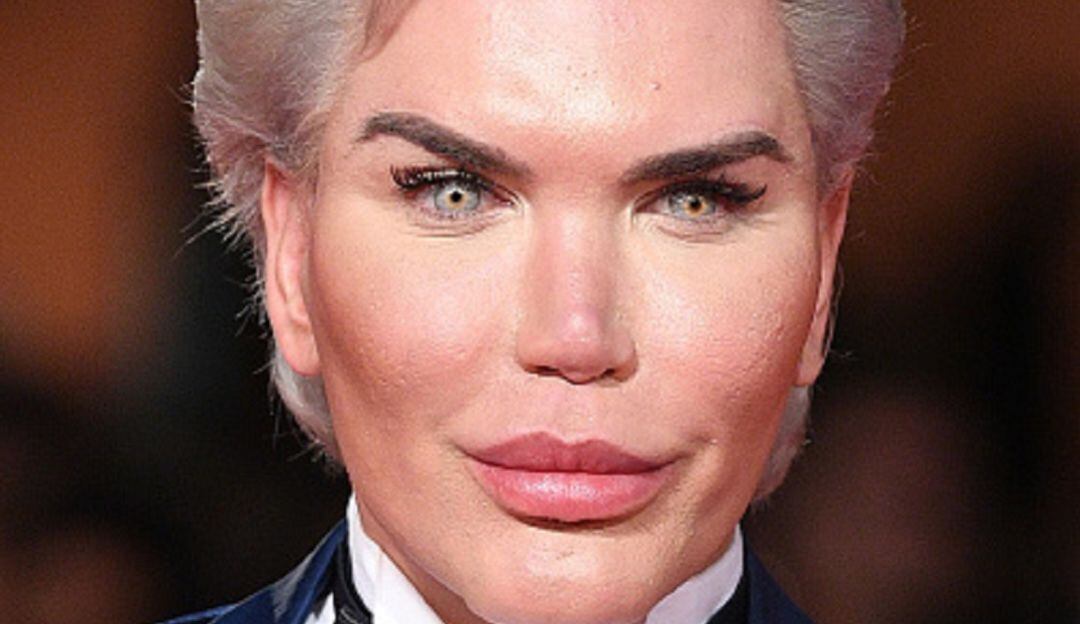 Rodrigo Alves, el "Ken Humano"
