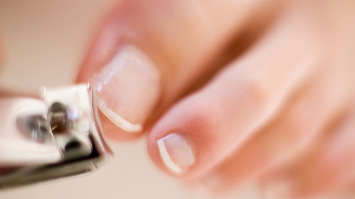 Cada cuánto se recomienda cortar las uñas de los pies: Largo adecuado según médicos