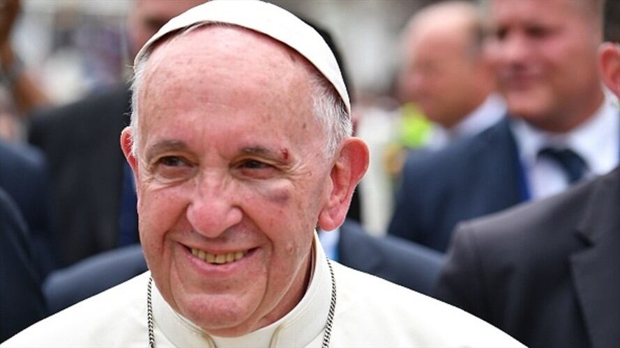 El momento en que el papa Francisco se golpea con uno de los parales del papamóvil. Foto: Getty Images