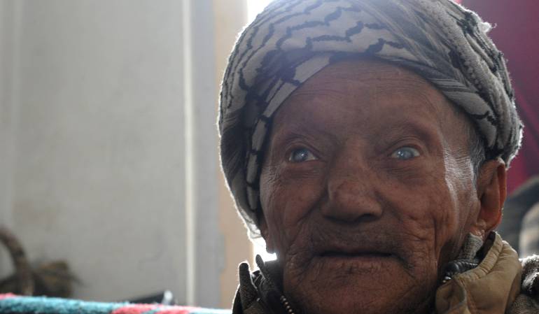  La lepra es causada por la bacteria Mycobacterium leprae. No es muy contagiosa y tiene un largo período de incubación