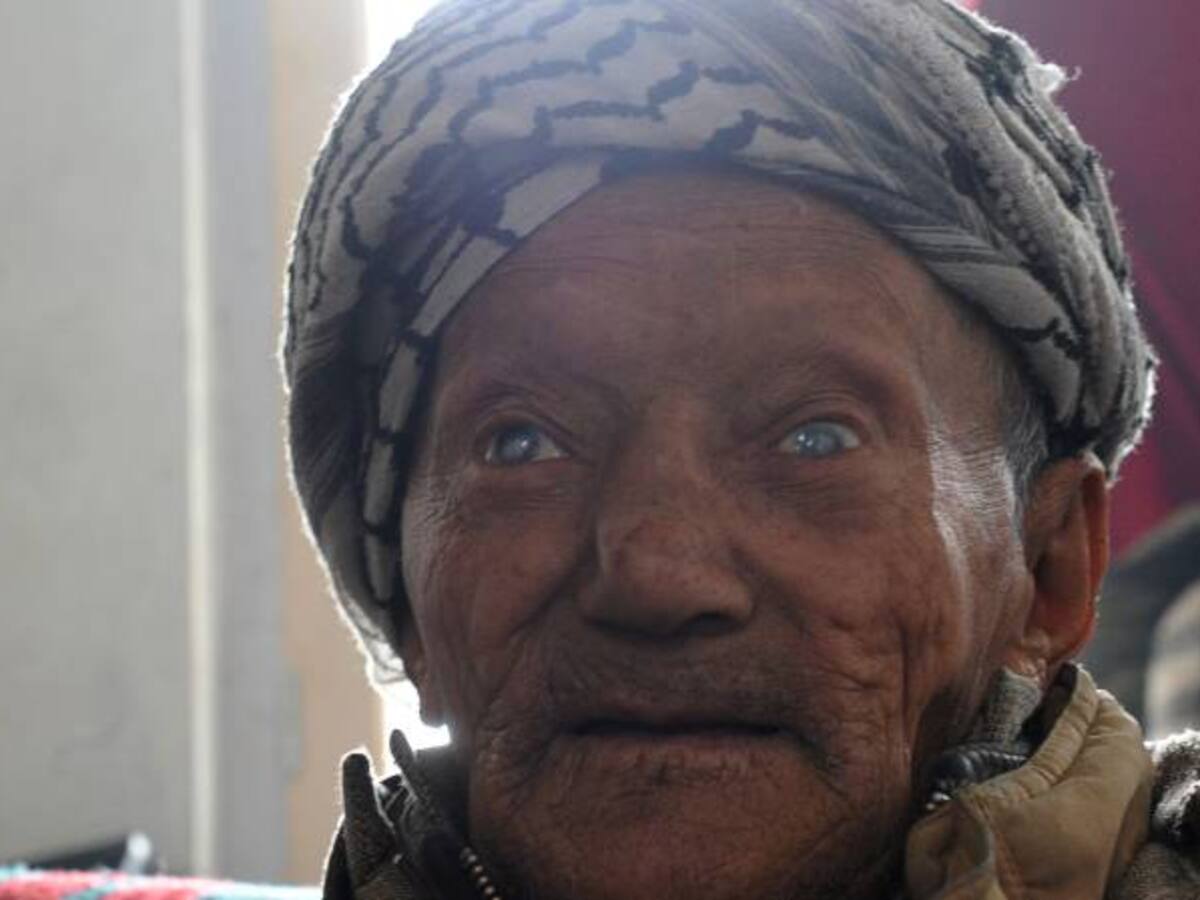 Mañana se conmemora el día mundial contra la lepra