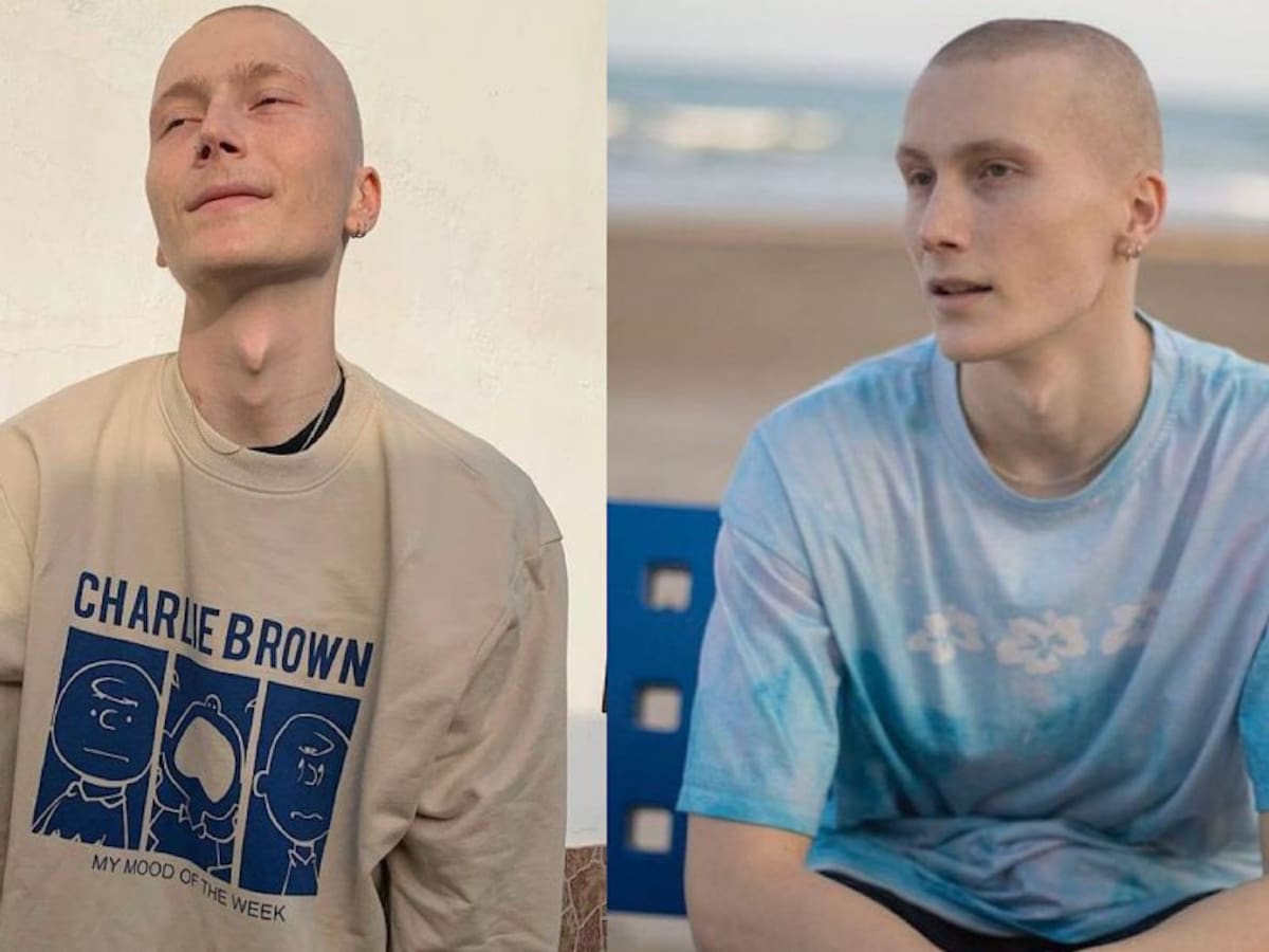 Murió Charlie, el tiktoker que luchaba contra el cáncer